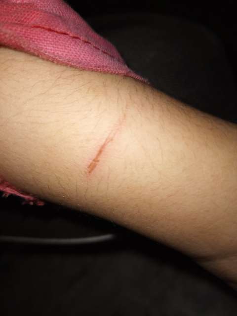 Raksha ripped